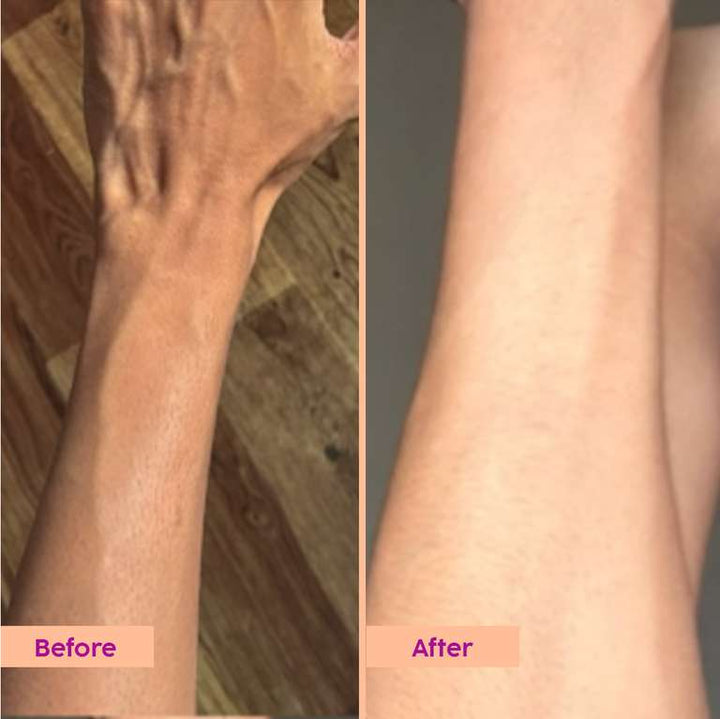 Plix Peaches & Lemon Detan Body Lotion with SPF 30 | Brightens & Moisturizes for Softer Skin, 150ml