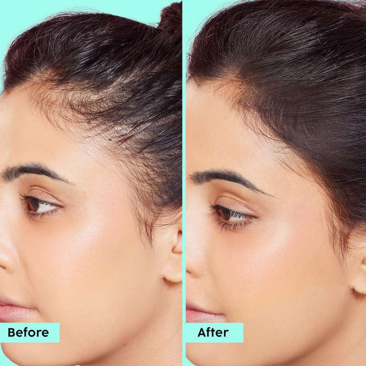 Plix Rosemary Advanced Hair Oil for Stronger Hair Follicles & Healthy Hair Growth, 100ml