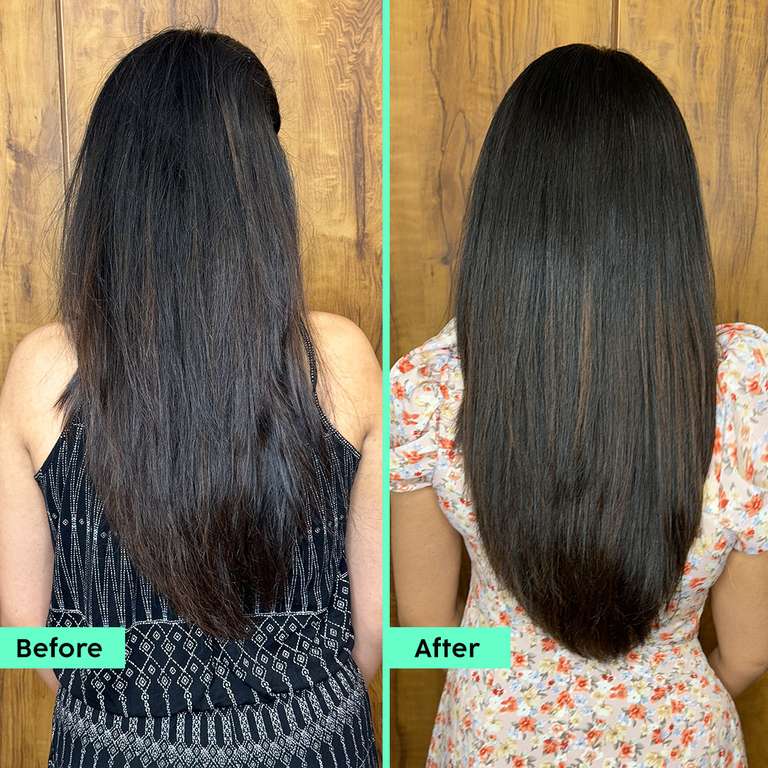 Plix Rosemary Anti-Hair Fall Advanced Conditioner for Soft, Smooth & Shiny Hair, 175ml